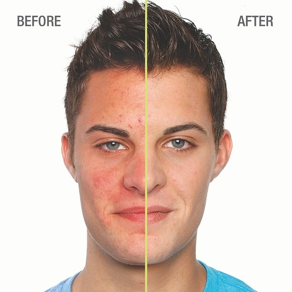 Juice Beauty Blemish Clearing Serum (60ml) - Picture 7 of 8